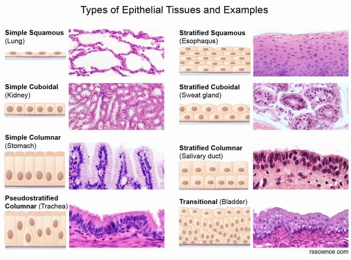 Which epithelial type is highlighted