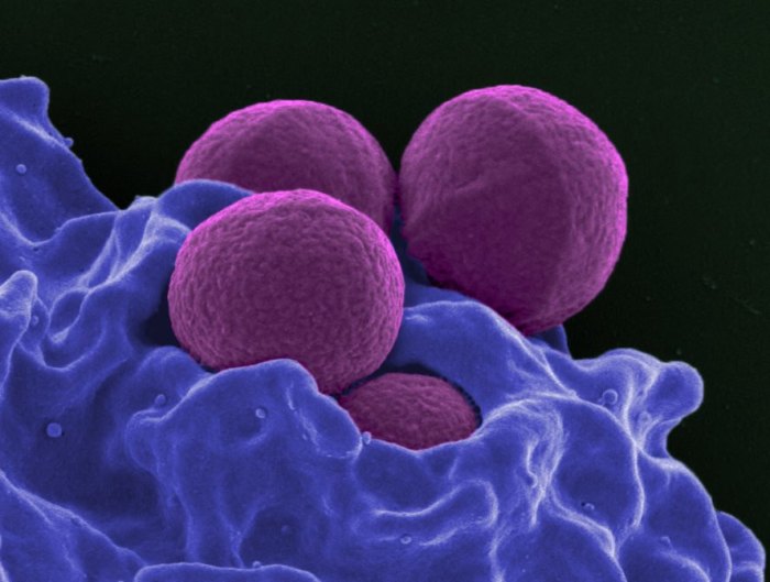 Bacteria and resistance what is mrsa worksheet answers